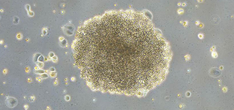 Mecanismo molecular clave mejoraría eficacia de la quimioterapia