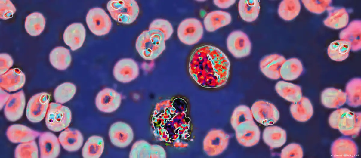 Esto sabemos de la misteriosa enfermedad en RDC