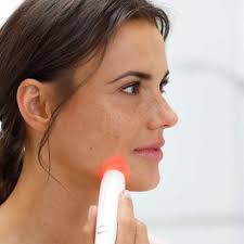 Adiós a los granos: pruebo tres dispositivos antiacné que funcionan