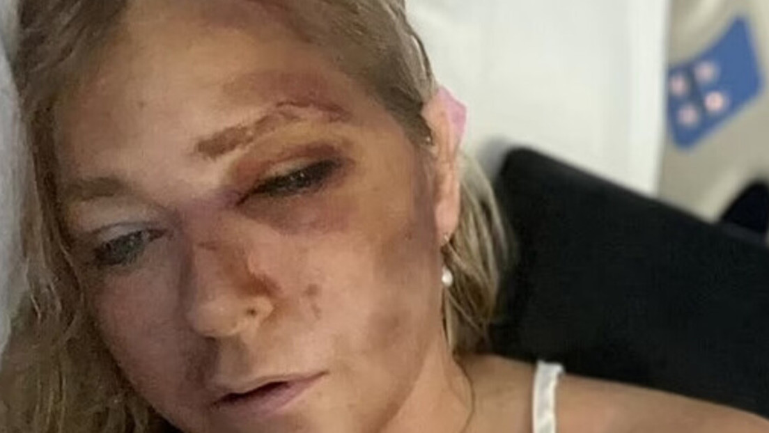 Surgen detalles del accidente de tráfico de una víctima de Epstein que dijo que le quedaban “días” de vida